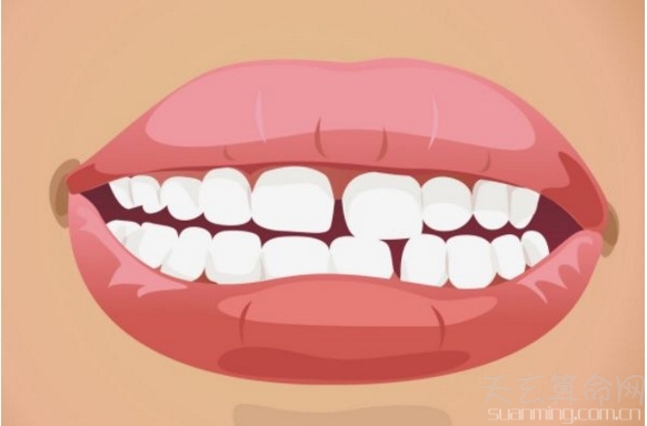 门牙中间有缝的面相命运解析  牙齿中间有缝易漏财